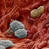 Alveolar-macrophagen